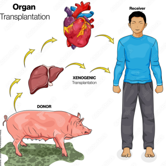 Opening your heart and mind to xenotransplantation